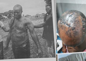 Tortured, Silenced, Then Prosecuted: Fredrick Namara’s Battle Against a Powerful Military Officer